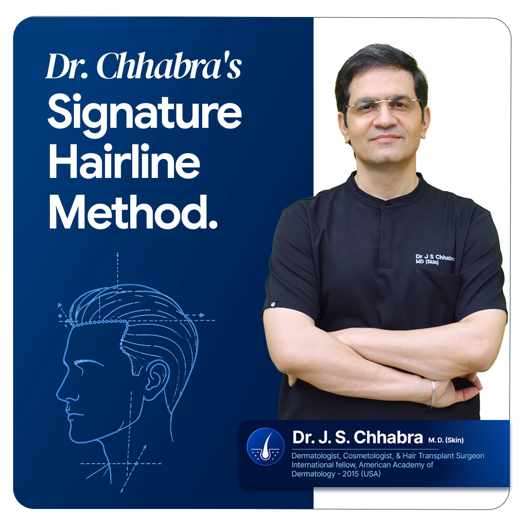 Dr Chhabra Signature Style Hair transplant Architect Banner V2 (1)