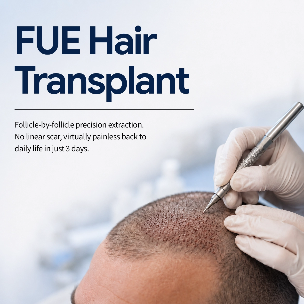FUE Hair Transplant